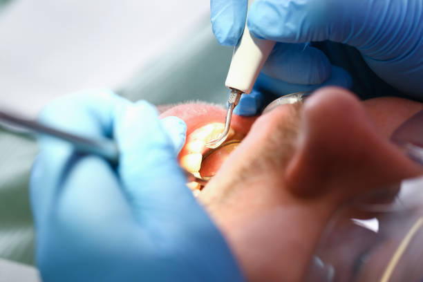 Best Emergency Root Canal Treatment in Unicoi, TN