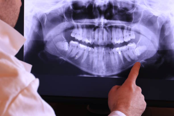 Best Emergency Treatment for Dental Infections or Abscesses in Unicoi, TN